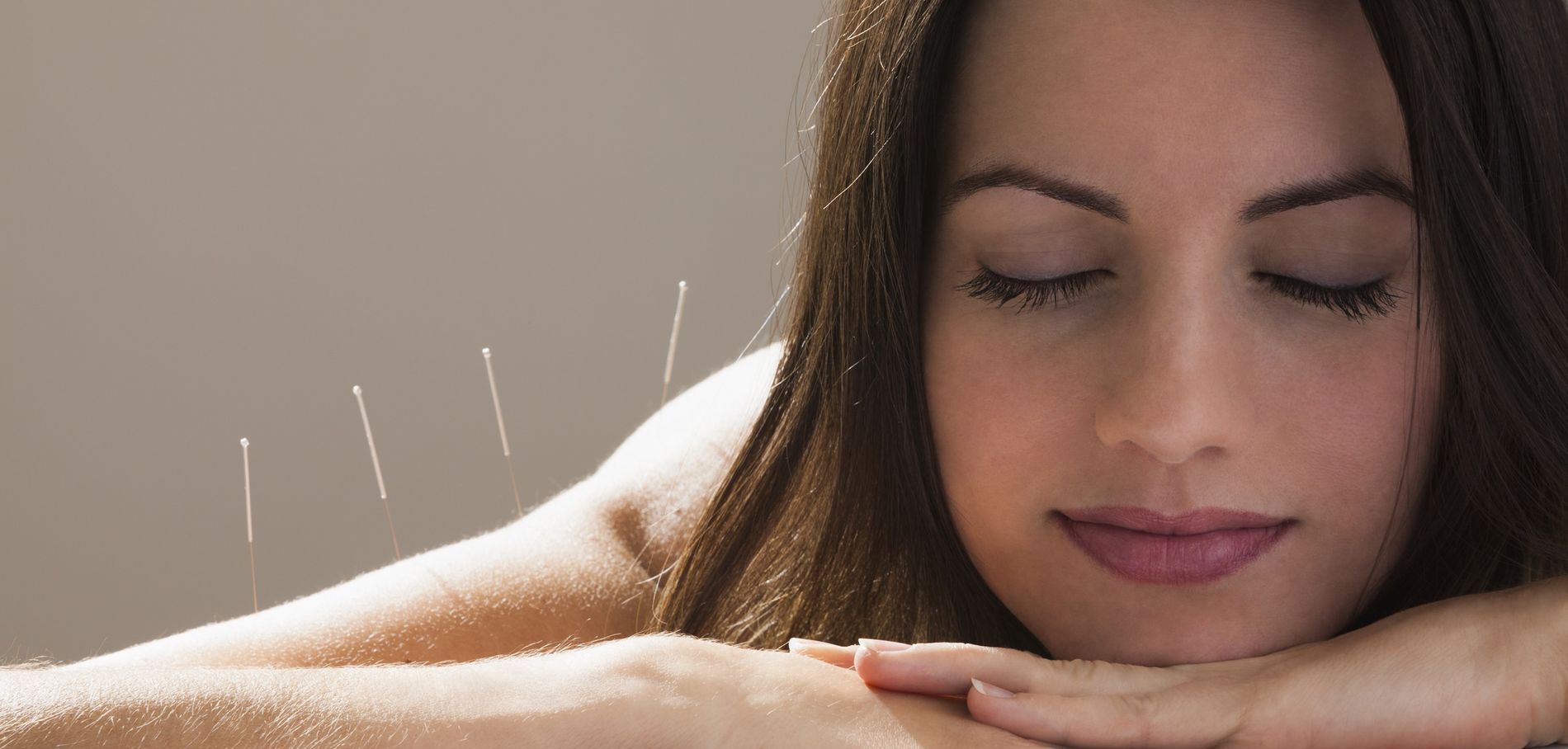 Acupuncture: la médecine chinoise qui peut tout guérir | Yatoo